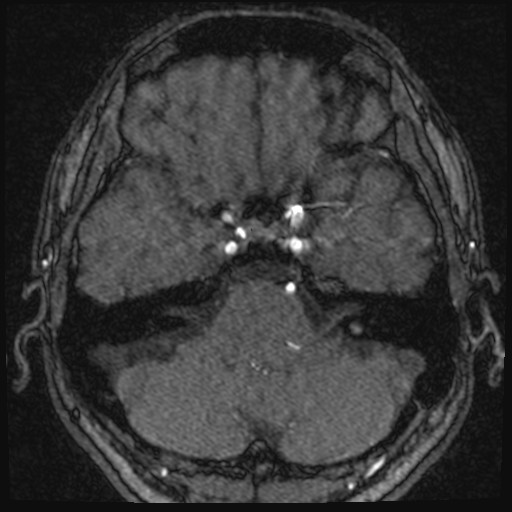 Click on the Serie image to view the images of VILLANUEVA, WILLIAM A.